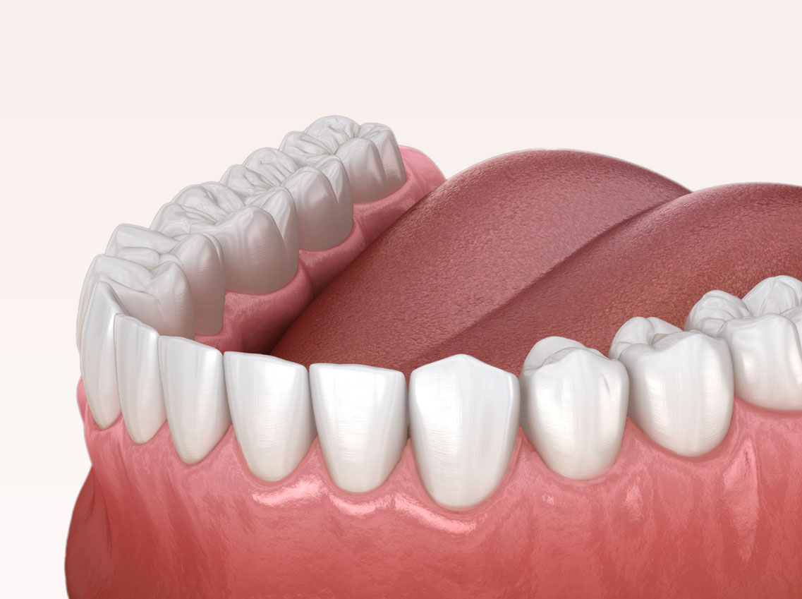 Zahnreinigung Dentalreinigung Altendorf